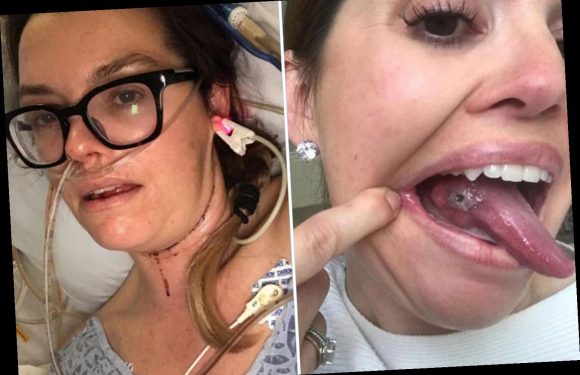 Healthy mom, 37, felt 'betrayed by my body' after shock cancer discovery from bump on tongue she thought she'd bitten