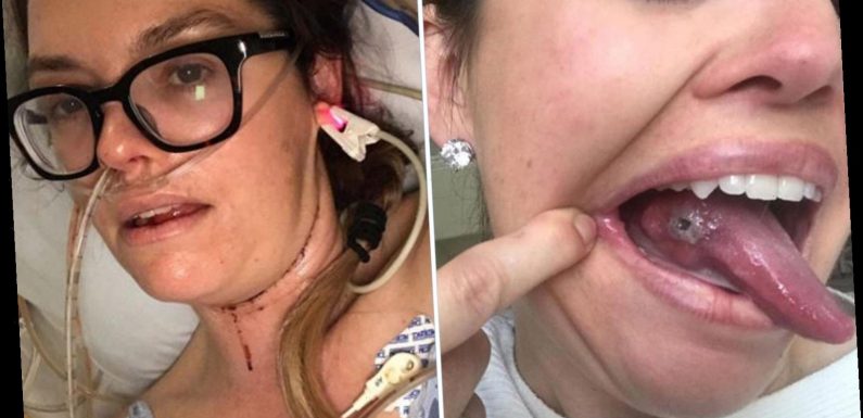 Healthy mom, 37, felt 'betrayed by my body' after shock cancer discovery from bump on tongue she thought she'd bitten