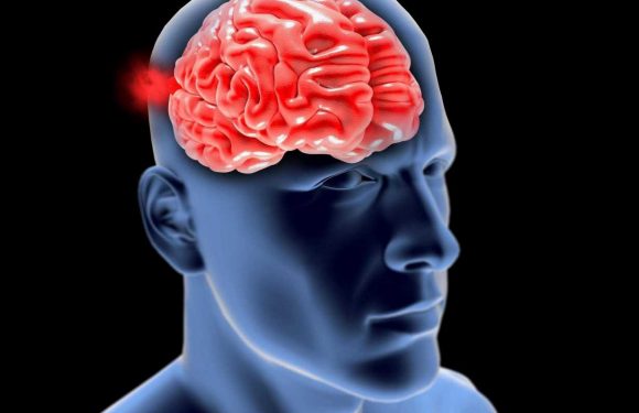 What is a brain aneurysm? – The Sun