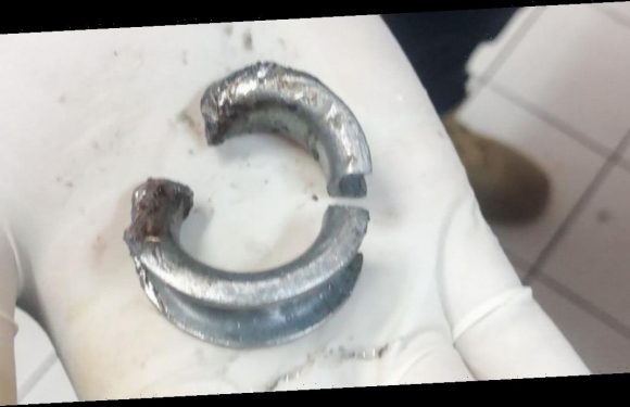Man rushed to hospital after putting ring on penis trying to make it bigger