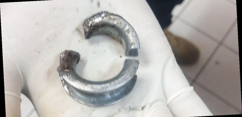 Man rushed to hospital after putting ring on penis trying to make it bigger