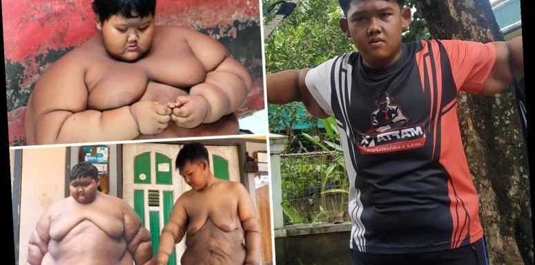 World's fattest boy shows off his trim physique after shedding 17 STONE and horrendous excess skin