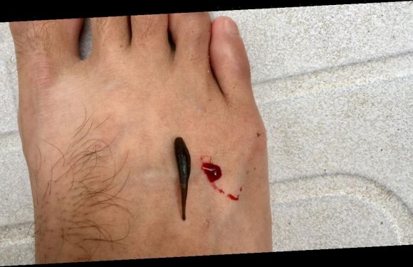 ‘I keep massive leeches as pets and let them suck on my blood’