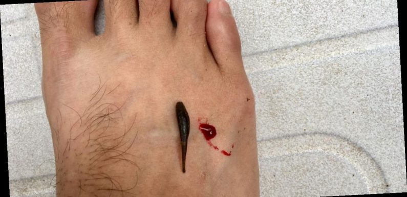 ‘I keep massive leeches as pets and let them suck on my blood’