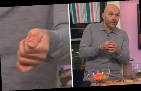 ‘Carrot and blood’ Sunday Brunch fans grossed out as Simon Rimmer cuts thumb while cooking