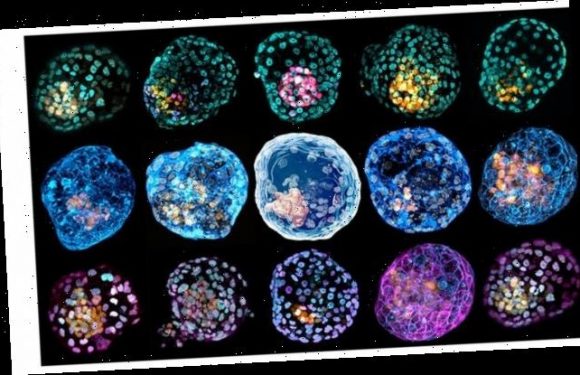 Scientists create a model of an early human embryo from SKIN CELLS