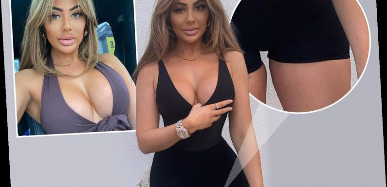 Chloe Ferry fans accuse her of 'photoshop fail' in sexy new pic of star