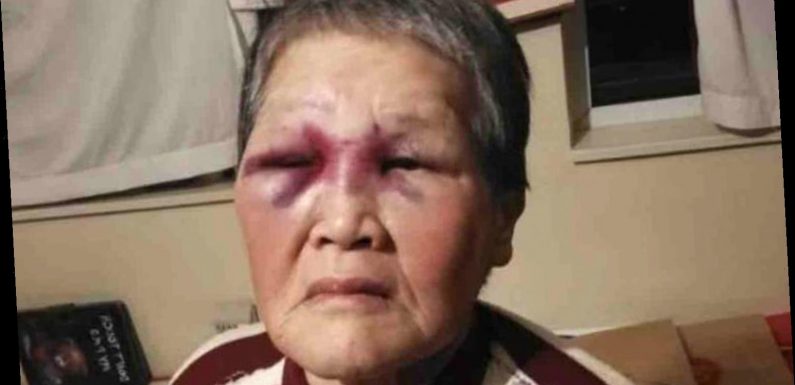 Asian Woman in Calif. Allegedly Attacked by Stranger Turns the Tables on Him, Fights Back with Bat