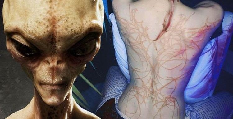 Elon Musk’s girlfriend Grimes has back covered in ‘alien scars’ tattoo – ‘Hurts too much’