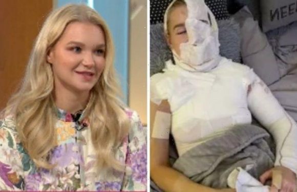 Abbie Quinnen feared ‘face would never be the same’ as she makes first TV appearance