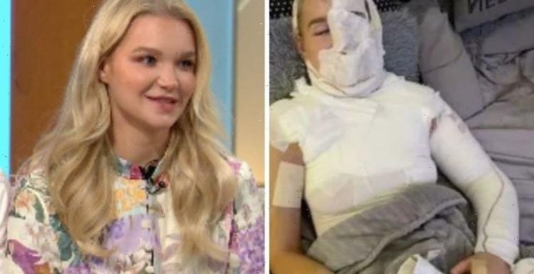 Abbie Quinnen feared ‘face would never be the same’ as she makes first TV appearance