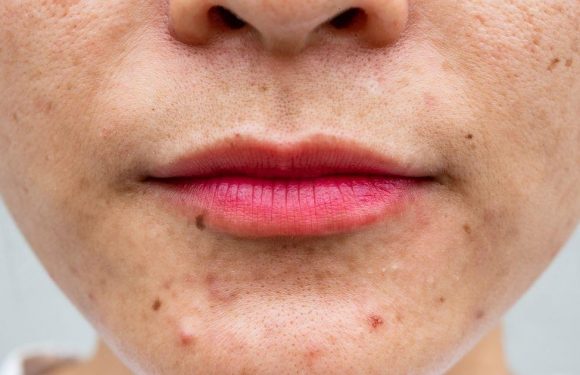 ‘Dr Google’ AI dermatologist can diagnose 288 skin conditions in virtual clinic