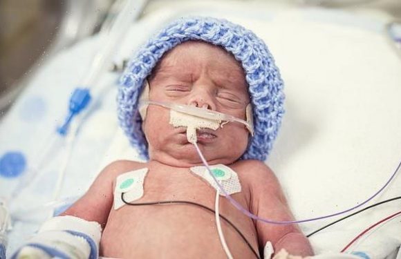 Premature boys born with an extremely low birth weight age FASTER