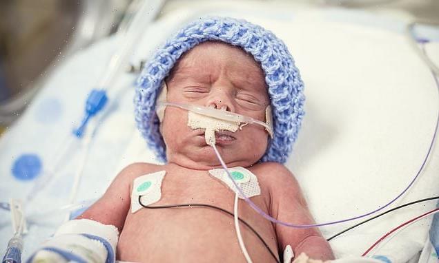 Premature boys born with an extremely low birth weight age FASTER
