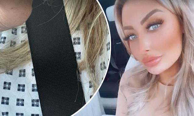 Love Island's Chloe Crowhurst in hospital after a  car accident