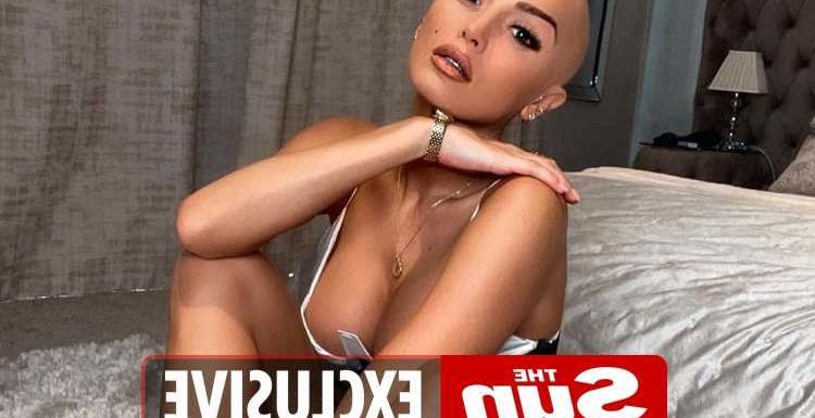 Alopecia left me bald, suicidal & dreading sex, now trolls call me a 'fake alien': Ex on the Beach's ZaraLena Jackson