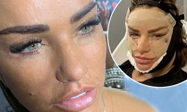 Katie Price shares 'completely unfiltered' close-up shot of her face