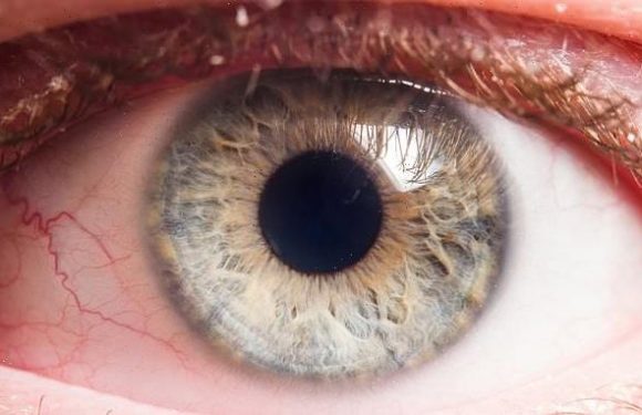 New glaucoma test 15x more likely to identify at risk people in time