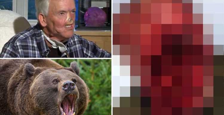 World's most horrific bear attacks revealed as beasts shatter skulls, pulp faces and skin victims alive