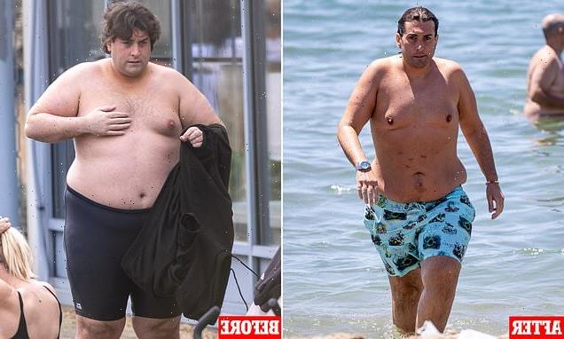 James Argent shows off seven stone weight loss after surgery