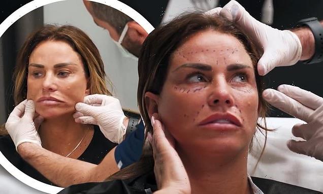 Katie Price documents her fourth face lift in a graphic YouTube video
