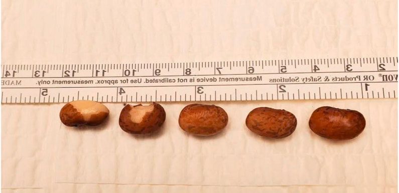 Man stuffs 6 kidney beans up penis in sex experiment leaving him needing surgery