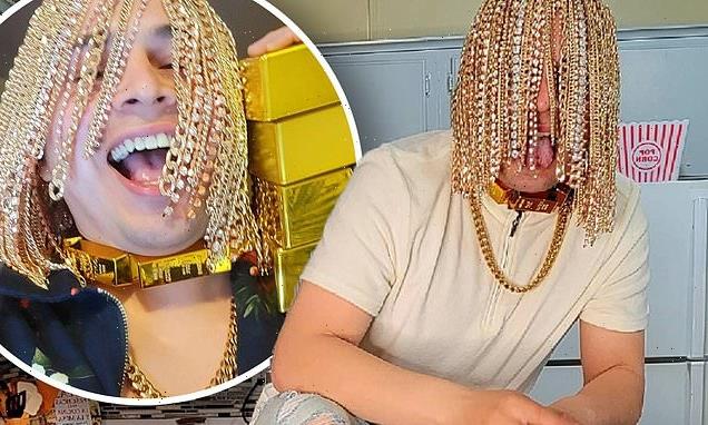 Dan Sur goes viral after implanting numerous gold chains on his head