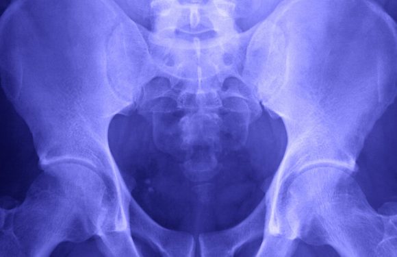 How Humans Lost Their Tails