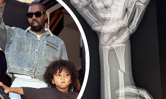 Kanye West posts X-rays of son Saint, five, showing his broken arm