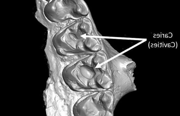 Oldest cases of mammal tooth decay in 54-million-year-old fossils