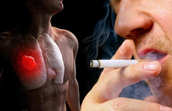 Cancer breakthrough as wonderdrugs target 80% of lung tumours after ‘unique’ find