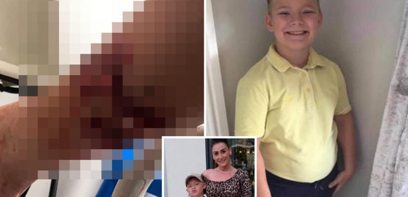 Boy, 10, screams ‘I’m going to die’ after horrific dog savaging left him ‘looking like shark attack victim’