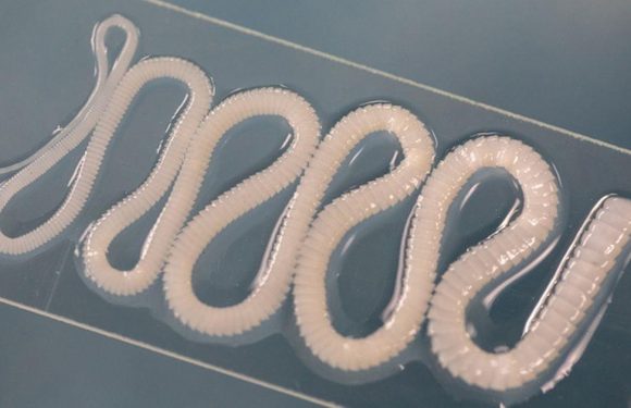 Man left ‘talking gibberish’ after tapeworm discovered eating his brain