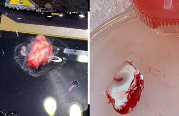 Slice of human BRAIN is kept alive in a petri dish for twelve hours