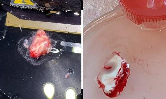 Slice of human BRAIN is kept alive in a petri dish for twelve hours