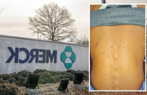 US on smallpox alert after vials of lethal virus ‘incidentally’ found in vaccine lab