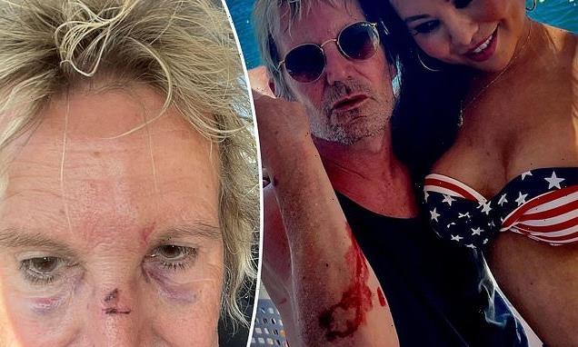 Brian Mannix 'attacked by a shark' while sailing on Sam Newman's yacht