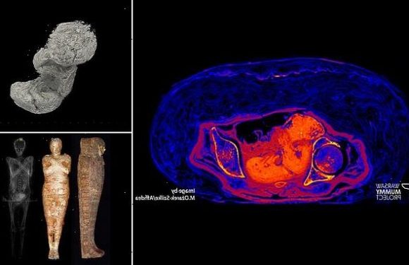 Foetus preserved within a mummy was 'PICKLED' by acidification