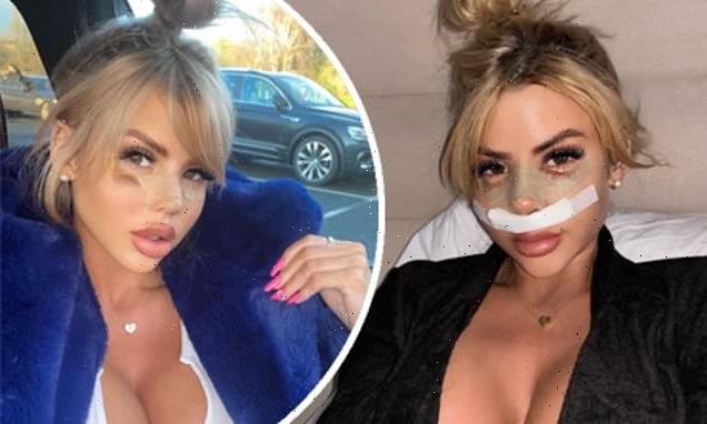 Hannah Elizabeth unveils the results of her nose job