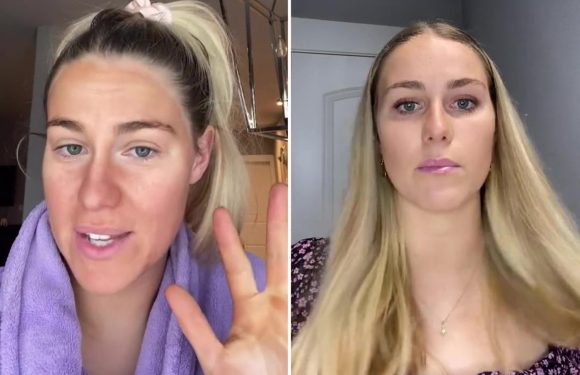 I only used four drops of fake tan on my face, I thought it would be fine… learn your lesson from me