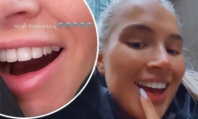 Molly-Mae Hague is left with 'dagger' tooth after chipping it