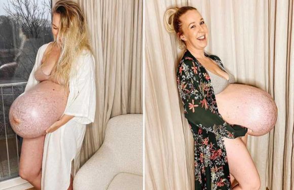 Mum of triplets shows off GIANT baby bump which had her in ‘severe pain’ as people call her a real superhero
