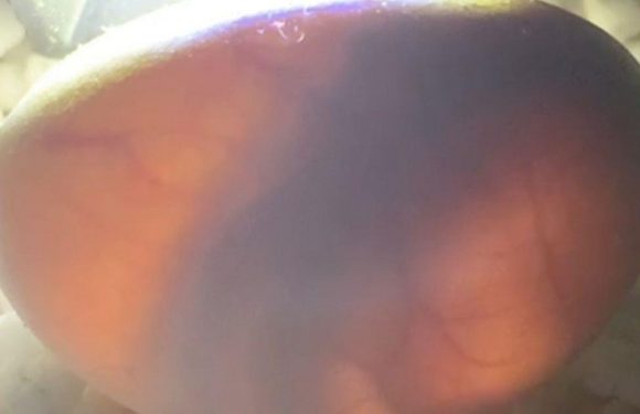 ‘Alien-like eggs’ containing the world’s most venomous animals spark horror