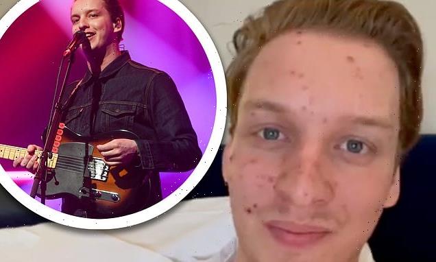 George Ezra reschedules live shows as he falls ill with chickenpox