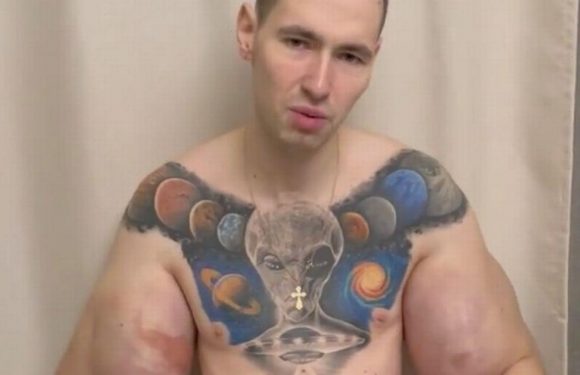 Russian Popeye with oil injected huge muscles sparks grave fears with defiance