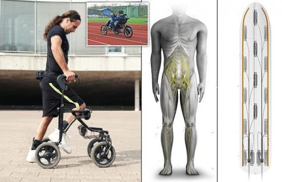 Three paraplegics are able to walk thanks to a spinal cord implant