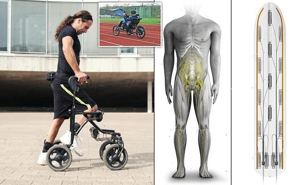 Three paraplegics are able to walk thanks to a spinal cord implant