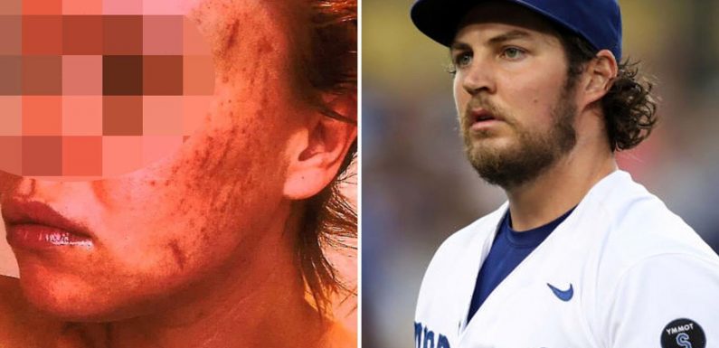 Trevor Bauer administrative leave extended after woman claimed Dodgers pitcher 'raped and choked her in sex assault'