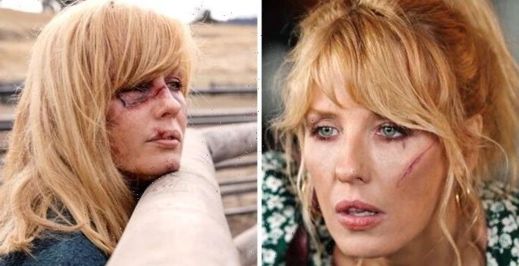Yellowstone: Hidden meaning in Beth Dutton’s scars exposed ‘It tells a story’