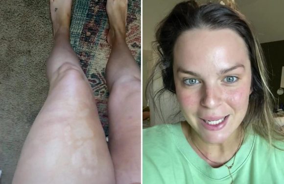 I fell asleep with fake tan on and woke up having had a huge beauty fail thanks to my son